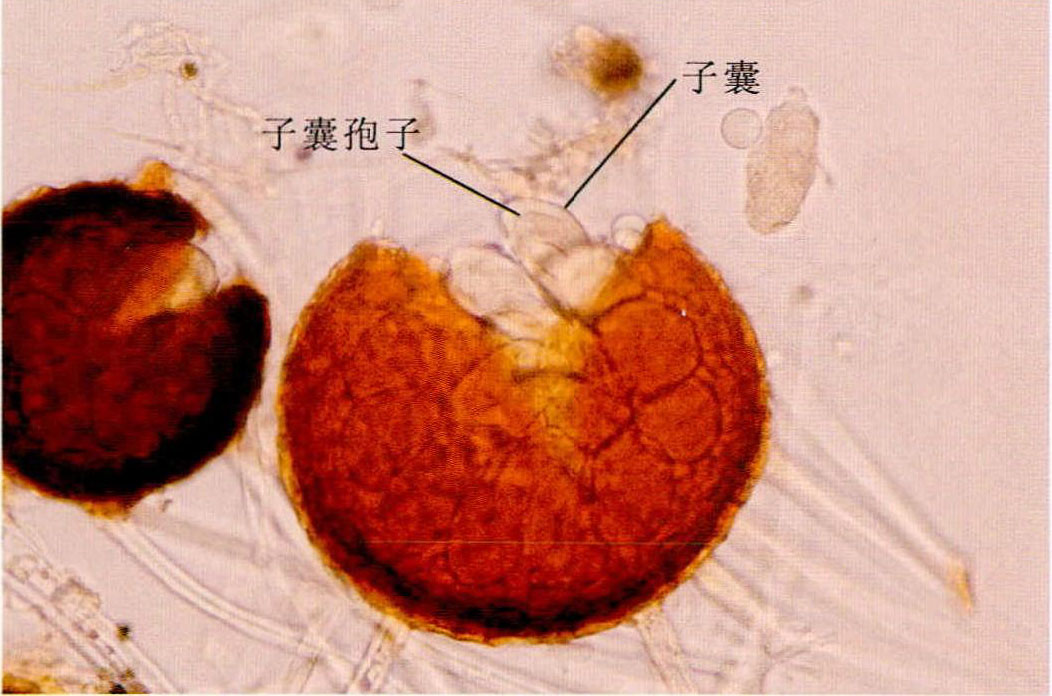 2-19 子囊孢子